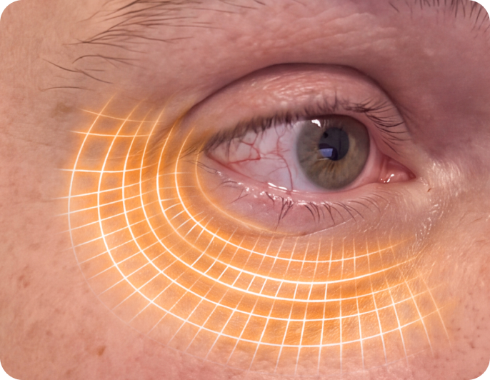 Dry, sensitive, or inflamed?
