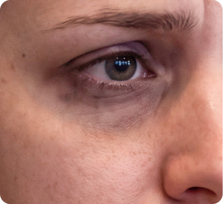 Tight, fatigued, or overworked?