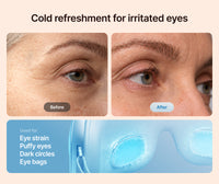 Eyeris Thermacool Eye Massager