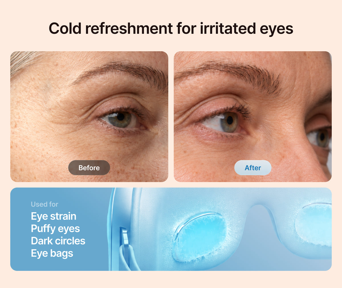 Eyeris Thermacool Eye Massager