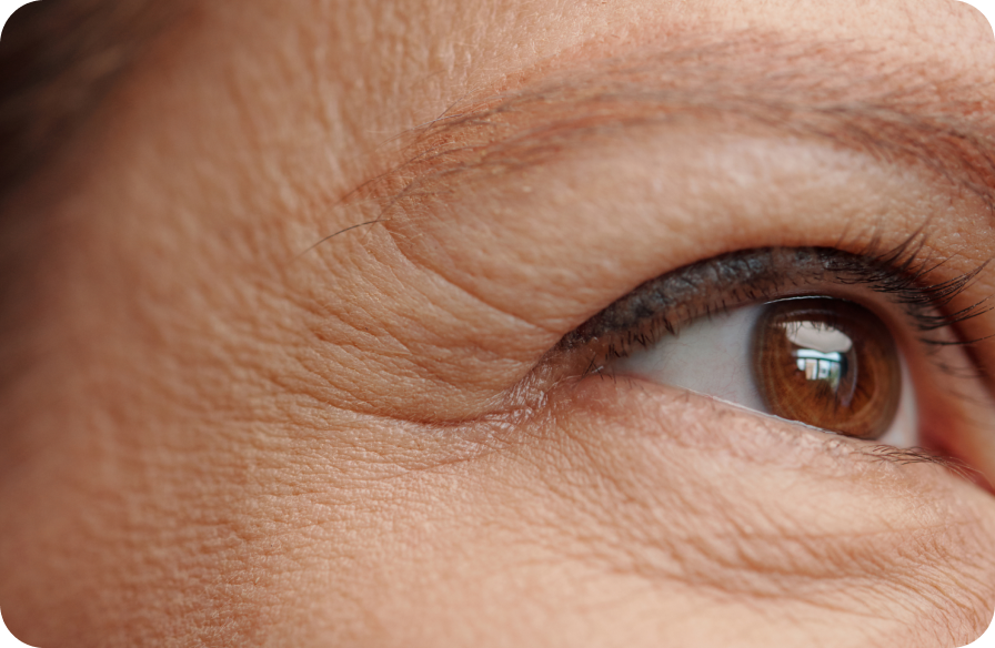 Fine lines, wrinkles, dark spots
